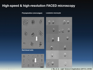 New technology provides more than 100 times faster in scan speed with high image resolution