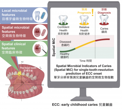 HKU Dentistry developed Spatial-MiC, the world’s first AI system for early childhood caries detection at the single-tooth resolution.